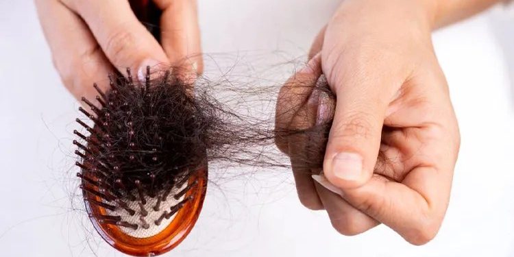 Which supplements cause hair loss_ کدام مکمل ها باعث ریزش مو میشوند؟
